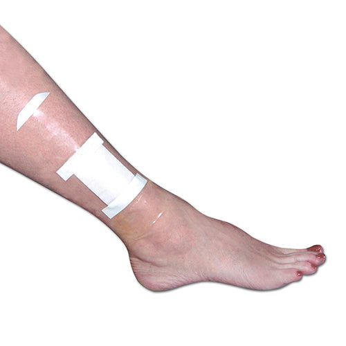 SEAL-TIGHT Shield Waterproof Dressing & Wound Protector Patches, 5 Count