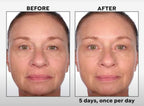 Black Rice 5-Day Brightening Serum